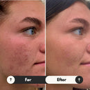 GlowRestore – Kojic og gurkemeje glødpads